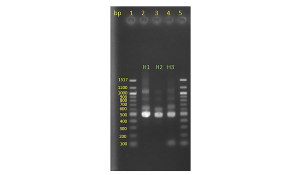 Agarose gel electrophoresis of ITS2 (plant DNA target) PCR products of three different honey samples.